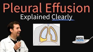 Pleural Effusion Explained Clearly  Causes Pathophysiology Symptoms Treatment [upl. by Ayhdiv346]