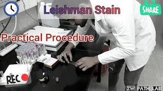 Leishman Stain  Practical Procedure [upl. by Aniras571]