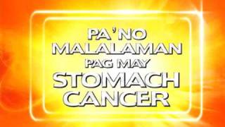 PINOY MD Stomach Cancer [upl. by Allenrac]