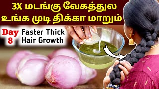 😱 3 வெங்காயம் போதும்  உங்க முடியை அடர்த்தியா மாத்த Thickness Hair Treatment tamil Jegathees meena [upl. by Ameen884]