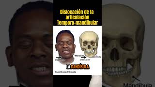 Tienes problemas mandibulares shortvideo [upl. by Apostles]