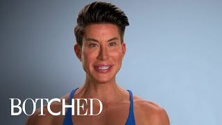 Human Ken Doll Is BACK With MORE Implants  Botched  E [upl. by Wiskind]