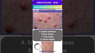 Cutaneous Signs and Diagnosis Quiz  Part 1 medicalmcqs dermatologyquiz [upl. by Etnasa]