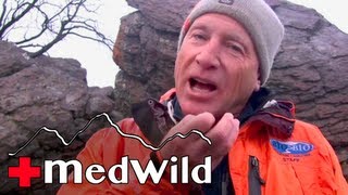 Wilderness Medicine Altitude Illness  Diamox Acetazolamide [upl. by Yelac746]