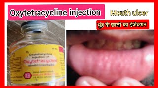 Oxytoxin injection l mouth ulcer l मुंह के छालो का इंजेक्शन l Oxytetracycline injection use in hindi [upl. by Way]