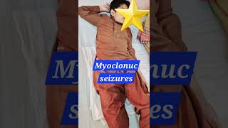 Myoclonic seizures  Myoclonus  SSPE  Epilepsy pediatrics neurology doctor [upl. by Bow]