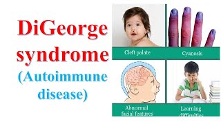 Digeorge syndrome Autoimmune disease [upl. by Karalynn545]