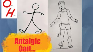 Antalgic gait [upl. by Otilegna]