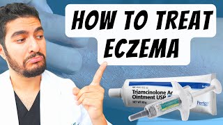 How To Treat Eczema Dermatologist Explains [upl. by Aizti]