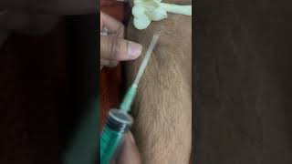 Blood sample collection technique 🩸💉nursing doctor hospitaltrending viralvideo shorts yt [upl. by Lull771]