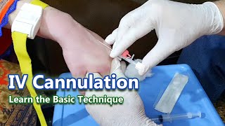 IV Cannulation  Learn the Basic Technique  IV Cannula [upl. by Alla452]