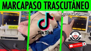 REPASO DE ARRITMIAS Parte 2Live por TikTok By Dr Zamarrón [upl. by Alvie3]