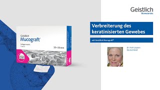 Verbreiterung der keratinisierten Gewebes mit Geistlich Mucograft® [upl. by Ittocs226]