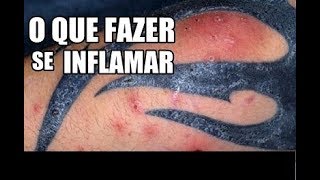 TATUAGEM INFLAMANDO COMO TRATAR A DOR E INFECÇÃO [upl. by Anile]