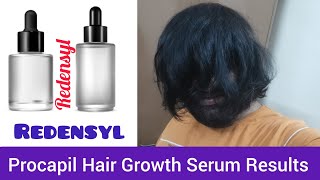 Procapil and Redensyl Hair Serum Results  25 Days Hair Growth Journey [upl. by Emilio]