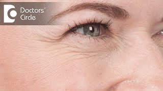 Does a Co2 Laser work for facial wrinkles  Dr K Prem Anand [upl. by Ainaj548]