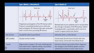 IM Cardiology 24 Arrhythmias Bradyarrhythmias Second degree AtrioVentricular Block  Mobitz II [upl. by Westley11]