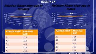 Risser stages menarche and other growth parameters in idiopathic scoliosis patients [upl. by Pucida584]