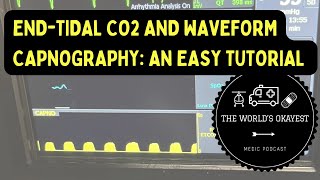 EndTidal CO2 and Waveform Capnography An Easy Tutorial Explicit [upl. by Dusa]