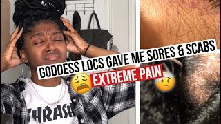 Getting Faux Locs Pain Sores amp Scabs  HeyLayah [upl. by Nodanrb]