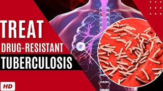 How to Treat Drug Resistant Tuberculosis [upl. by Ruhtracam588]