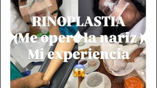 Mi experiencia con la RINOPLASTIA Parte 1 DOLIÓ❌😱😱 [upl. by Zamora752]