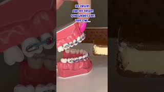 HOW TO EAT ICE POPS WITH BRACES ON 🥶🦷 ORTHODONTIST REACTS SATISFYING FOOD ASMR CRUNCHY TEETH [upl. by Nnaarat869]