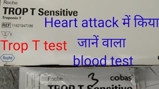 tropnin T test procedure  troponin t test method Trop t test for heart attack [upl. by Odnuges]