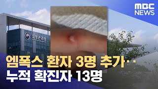 엠폭스 환자 3명 추가‥누적 확진자 13명 20230417뉴스외전MBC [upl. by Eciuqram]