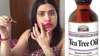 Top 10 ways to use TEA TREE OIL amp benefits for acne  face  hair  skin  body  टी ट्री ऑयल [upl. by Eilahtan]