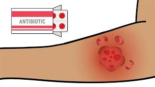 Xylazine 102 Focus on Wound Care [upl. by Anohr]