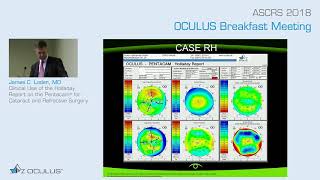 James C Loden MD Clinical Use of the Holladay Report on the Pentacam® for Surgery [upl. by Berkly]