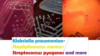 Klebsiella Streptococcus and Staphylococcus Colony Morphology Demonstration [upl. by Emmit]