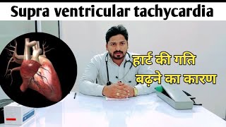 Heart attack Supra ventricular tachycardia हार्ट की गंभीर बीमारी [upl. by Aborn]