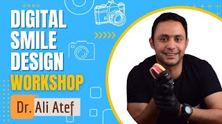 Digital Smile Design workshop  Dr Ali Atef [upl. by Gwen]