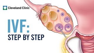 How Does In Vitro Fertilization IVF Work A StepbyStep Explanation [upl. by Sedecram]