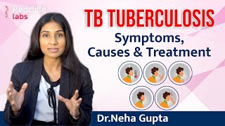 💹What is Tuberculosis TB Tuberculosis Symptoms Causes And Treatment  💹Symptoms of Tuberculosis [upl. by Kremer]