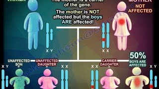 X Linked Recessive Inheritance  Everything You Need To Know  Dr Nabil Ebraheim [upl. by Inasah]