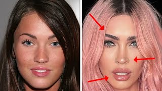 BOTCHED Celebrities Who Tried To Hide Their Plastic Surgeries  Part 2 [upl. by Margery760]