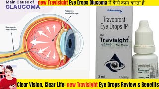 NEW TRAVISIGHT Eye Drop Review amp Glaucoma Management thepharmacistdrx travisighteyedroops [upl. by Sunday]