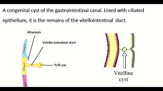 Embryology of vitellointestinal duct  formation fate amp congenital anomalies [upl. by Esineg495]