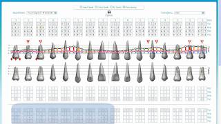 Periodontal Charting [upl. by Noreik930]