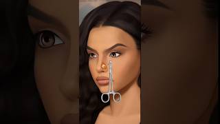 ASMR Animation Nose Piercing Infection Treatment  remove nose piercing amp pus [upl. by Almond]