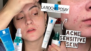 TESTING LA ROCHE POSAY EFFECLAR SKINCARE ROUTINE ON ACNE SENSITIVE DRY SKIN FOR 2 WEEKS [upl. by Neggem]