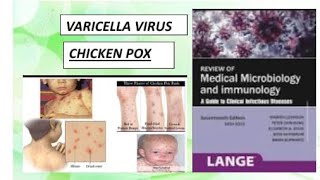 Microbiology amp Community medicine  Varicella zoster virus microbiology communitymedicine [upl. by Jodi811]