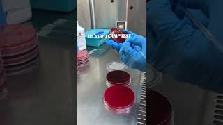 CAMP test for Streptococcus agalactiae  GBS and Listeria Microbiology [upl. by Heidi622]