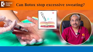 Can Botox STOP excess hand sweatingHyperhidrosisSweaty PalmsDrVenkataram MysoreDoctors Circle [upl. by Aitrop]