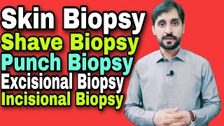 Skin Biopsy  Types of Skin Biopsy [upl. by Otes]