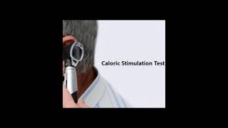 caloric stimulation test shortsscience facts [upl. by Annadal]