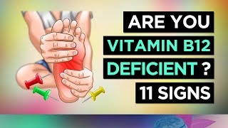 11 Symptoms Of A Vitamin B12 Deficiency [upl. by Anirod]